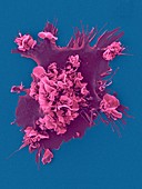 Human dendritic cell, SEM