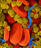 Bacterial blood infection (sepsis), SEM