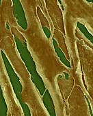 Human fibroblasts in culture, SEM