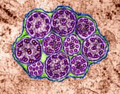 Epithelial cilia microtubules (cross section), TEM