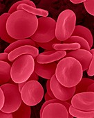 Red blood cells in isotonic solution, SEM