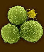 Human T lymphocytes and activated platelet, SEM