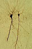 Hippocampus pyramidal neurons, LM Brightfield