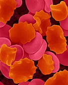 Red blood cells in hypertonic solution, SEM