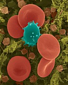 Red blood cells, white blood cell and platelets, SEM