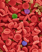 Red blood cells, white blood cells and platelets, SEM