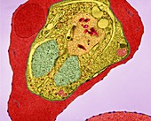 Plasmodium falciparum, TEM