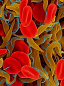 Trypanosome trypomastigote and red blood cells, SEM