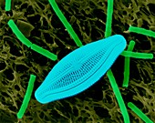 Diatom (Navicula sp.) and Bacillus megaterium, SEM