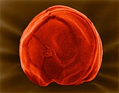 Dinoflagellate (Gambierdiscus toxicus), SEM