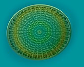 Centric diatom frustule, SEM