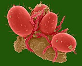Chigger mites on human skin (Trombicula sp.), SEM