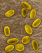 Bacillus anthracis spores, SEM
