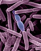 Bacillus anthracis, SEM
