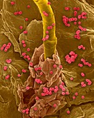 Enterococcus faecium on human skin, SEM