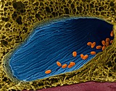Bacillus anthracis spores in lung, SEM