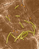 Bacillus anthracis, spore, prokaryote, SEM