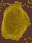 Staphylococcus aureus colony (MRSA strain), SEM