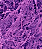 Oral bacterium, Actinomyces viscosus, SEM