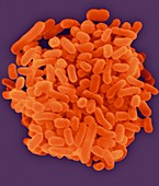 Oral bacterium, Porphyromonas gingivalis, SEM