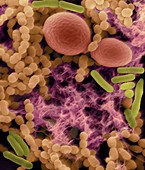 Bacteria (bacilli and cocci) and yeast, SEM