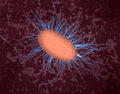 E. coli with fimbriae, TEM