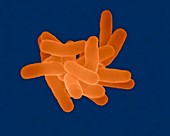 Tatlockia micdadei, bacterium, SEM
