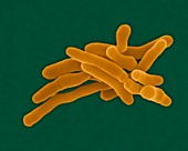 Rhodococcus fascians -rod prokaryote, SEM