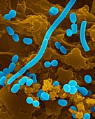 Acinetobacter sp., SEM