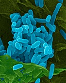Pseudomonas pseudomallei, bacterium, SEM