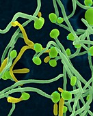 Candida albicans yeast and hyphae stages, SEM