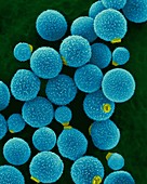Cryptococcus neoformans, SEM