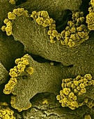 Crustose lichen Xanthomendoza fallax, SEM
