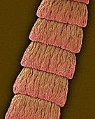 Dog tapeworm proglottids (Dipylidium caninum), SEM