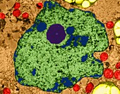 Plant parenchyma cell nucleus, TEM