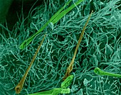 Nettle leaf surface (Urtica dioica), SEM