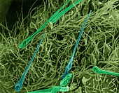 Nettle leaf surface (Urtica dioica), SEM