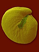 Quinoa seed (Chenopodium quinoa), SEM