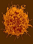 Human dendritic cells, SEM