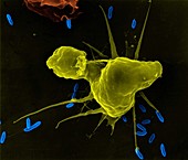 Alveolar macrophage phagocytosis of E. coli, SEM