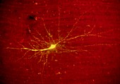 Cerebral cortex stellate neuron, LM Fluorescence