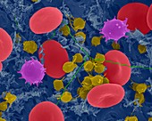 Red blood cells, monocytes, platelets and fibrin, SEM