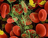 Red blood cells trapped in a fibrin blood clot, SEM