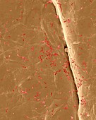 E. coli on the human skin surface, SEM