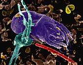 Dust mite (Dermatophagoides pteronyssinus), SEM