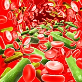 Bacterial blood infection, illustration