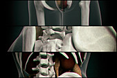 Human vertebrae