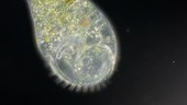 Stentor protozoan