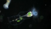 Stephanoceros rotifer, light microscopy footage