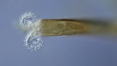 Limnias melicerta rotifer, LM